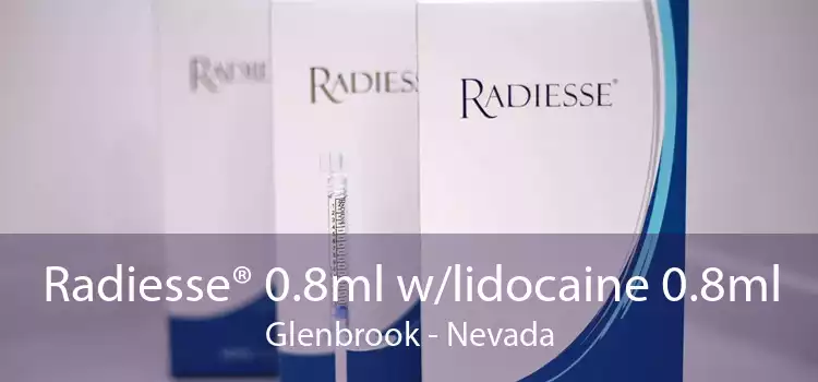 Radiesse® 0.8ml w/lidocaine 0.8ml Glenbrook - Nevada