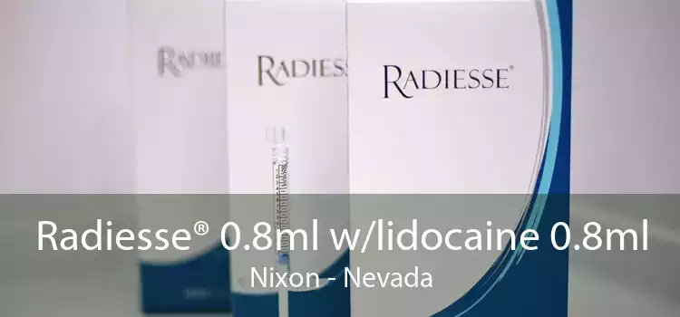 Radiesse® 0.8ml w/lidocaine 0.8ml Nixon - Nevada